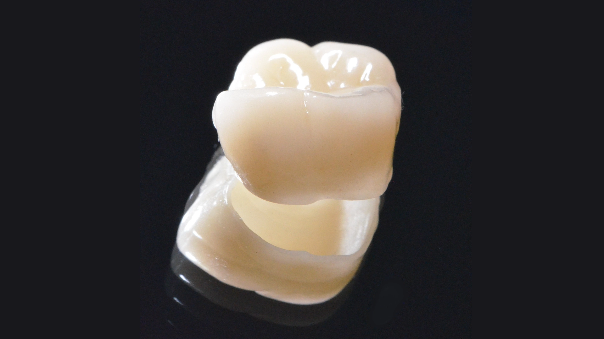 Tannkrone laget i porselen-metall.